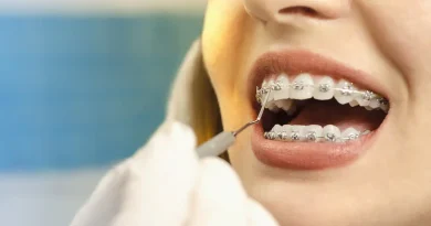 Dental Insurance for Students in Germany